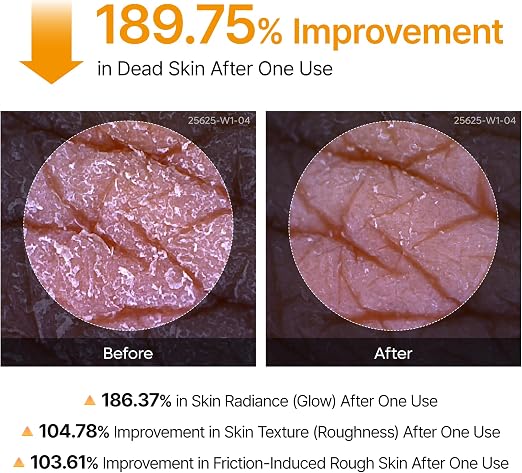 Dr. Melaxin Kojic Acid Brightening Cream – Dark Spot & Pigmentation Care